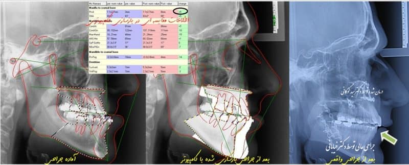 پیش بینی کامپیوتری نتایج درمان